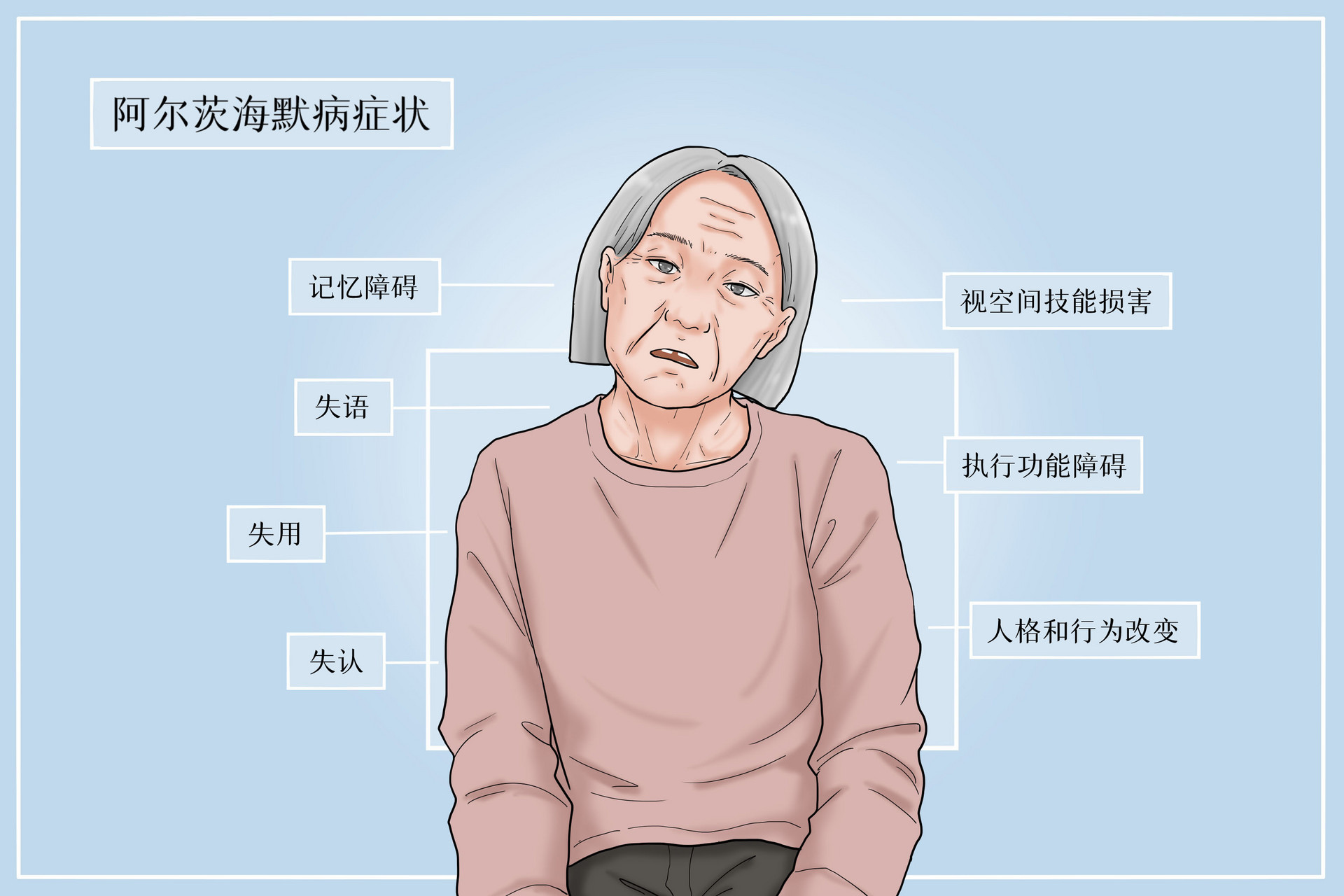 阿尔茨海默症症状表现 如何预防老年痴呆
