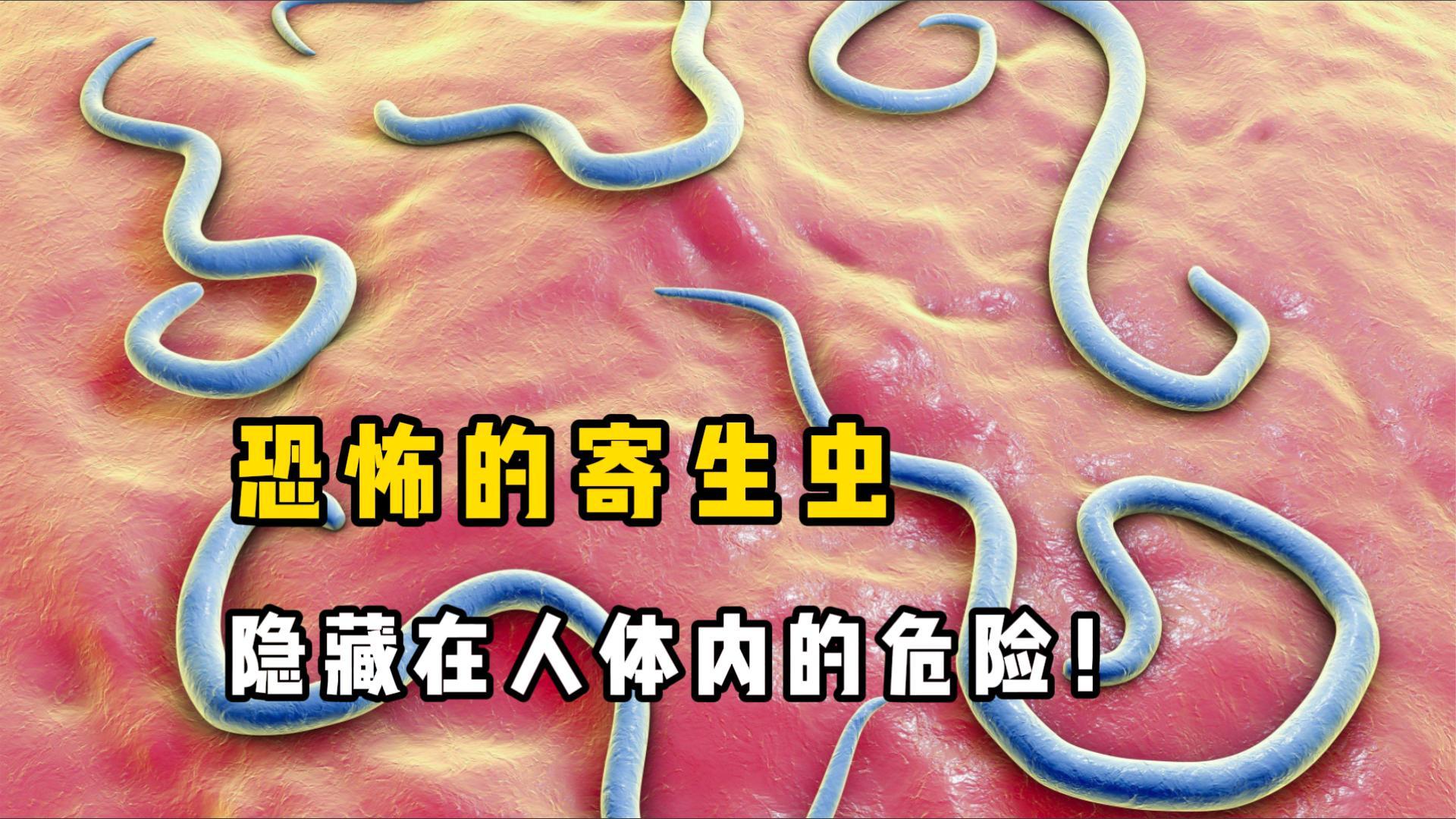 致命入侵:某种猫科动物的寄生虫为什么能劫持我们的大...