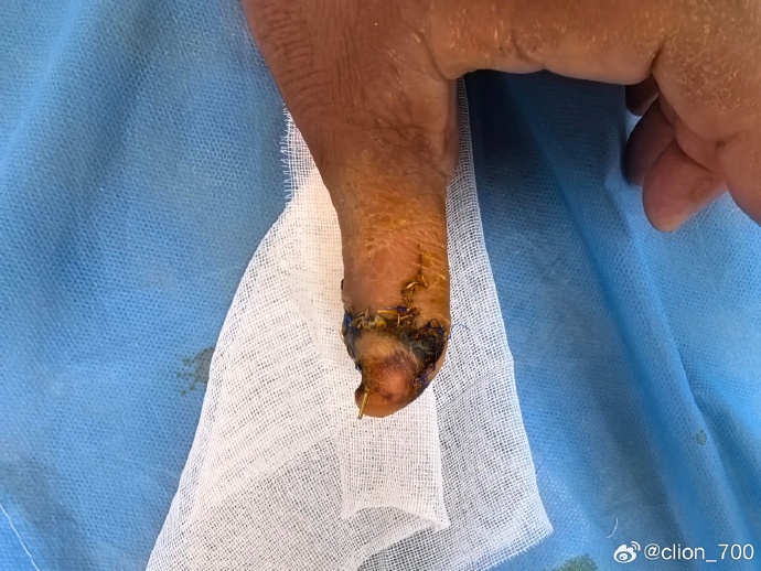 出乎意料的新闻：泰安万达公寓怎么找接活的？有效找活项目的方法技巧揭秘