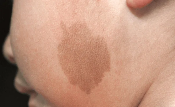 求小说 男主角胎记消失 精灵种族 男主设定有趣 多种小说推荐