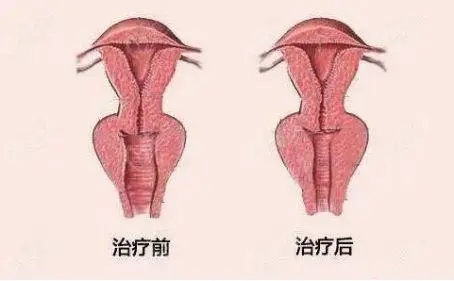 荣耀手机怎么设置下面三个按键