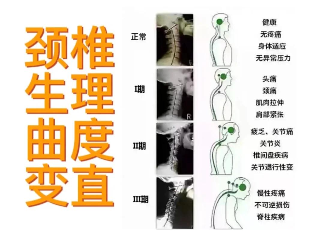 头疼怎么样可以缓解