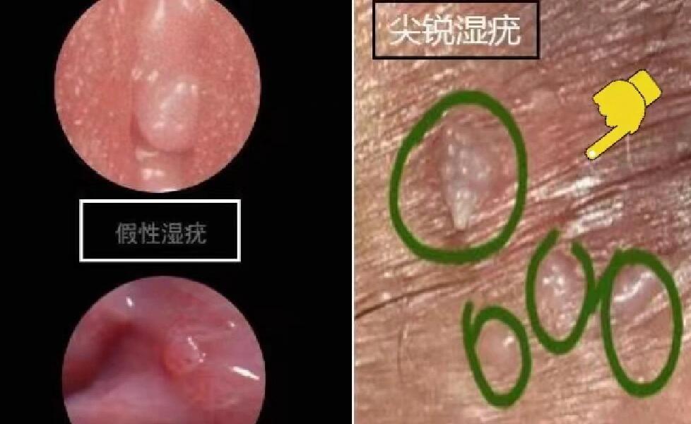 生殖器在下巴,肛门也在头上,这种奇特的生物为何长的...