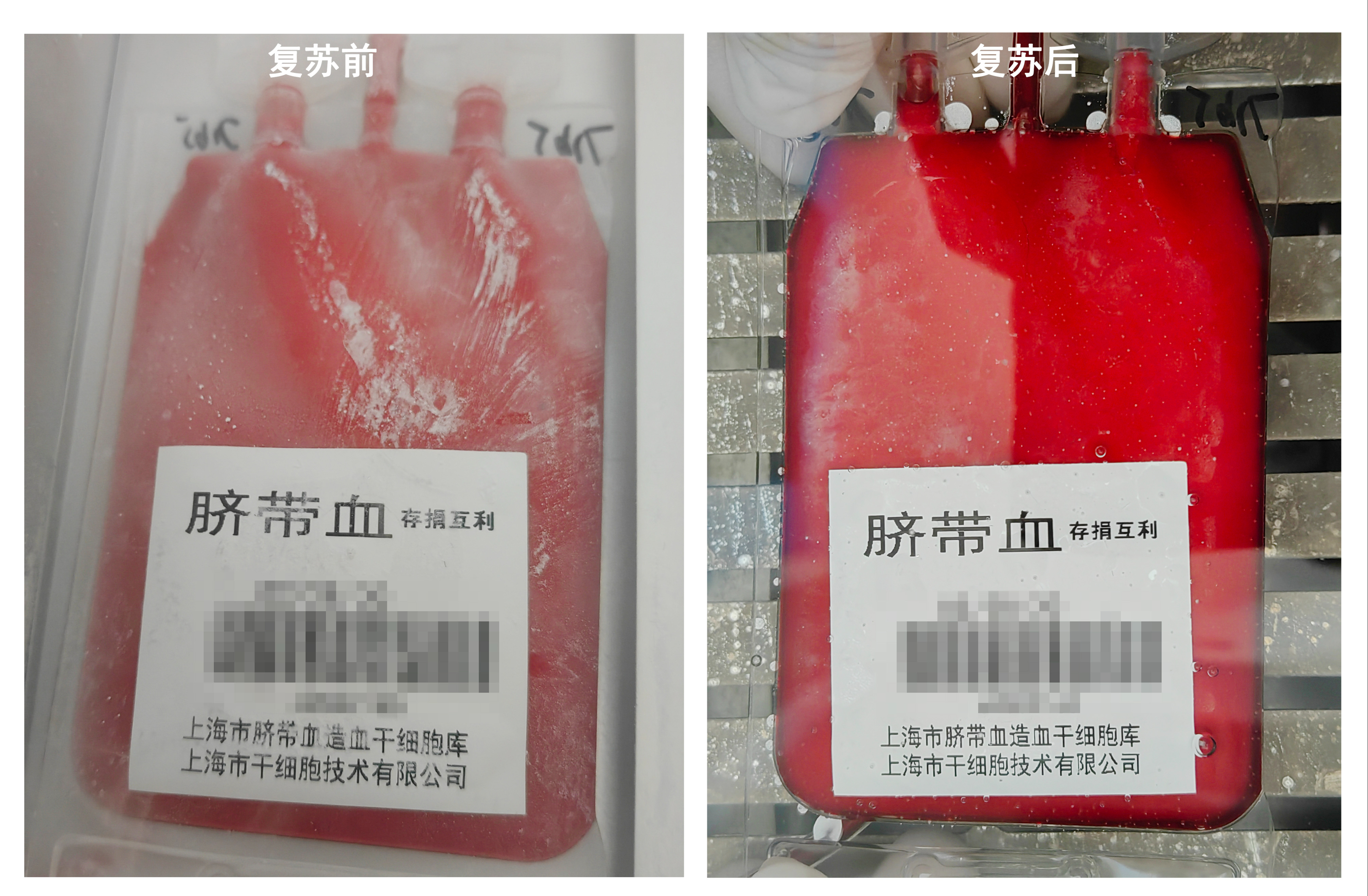 储存脐带血,“生命保险”还是“空头支票”?...