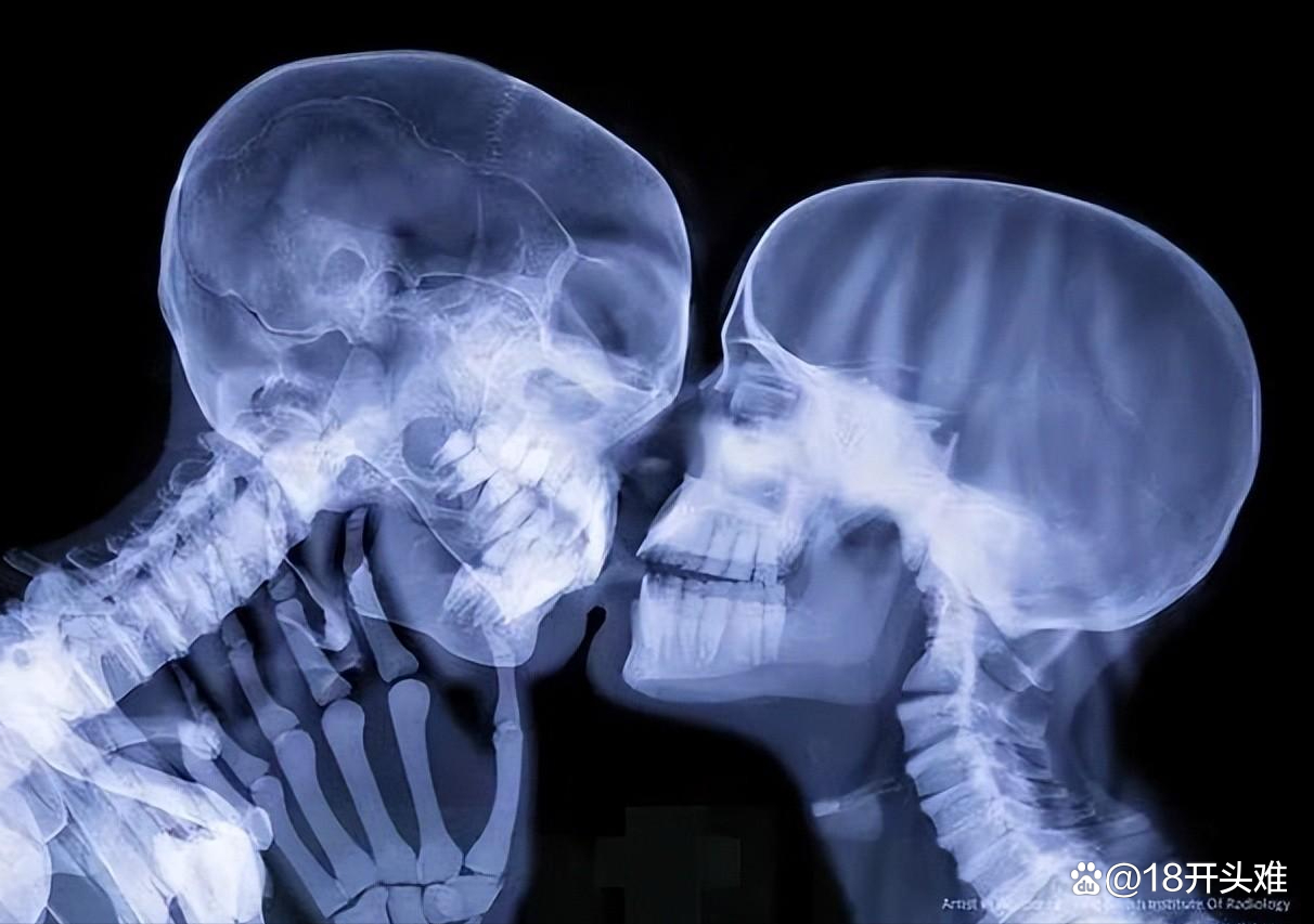 拍完X射线光片发现怀孕,孩子就不能要了?...