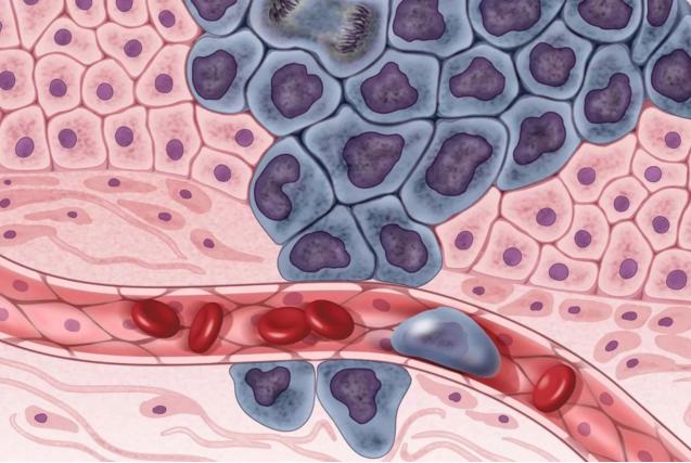 什么是癌症，哪些因素可能引发癌症？我们该如坷避免？...