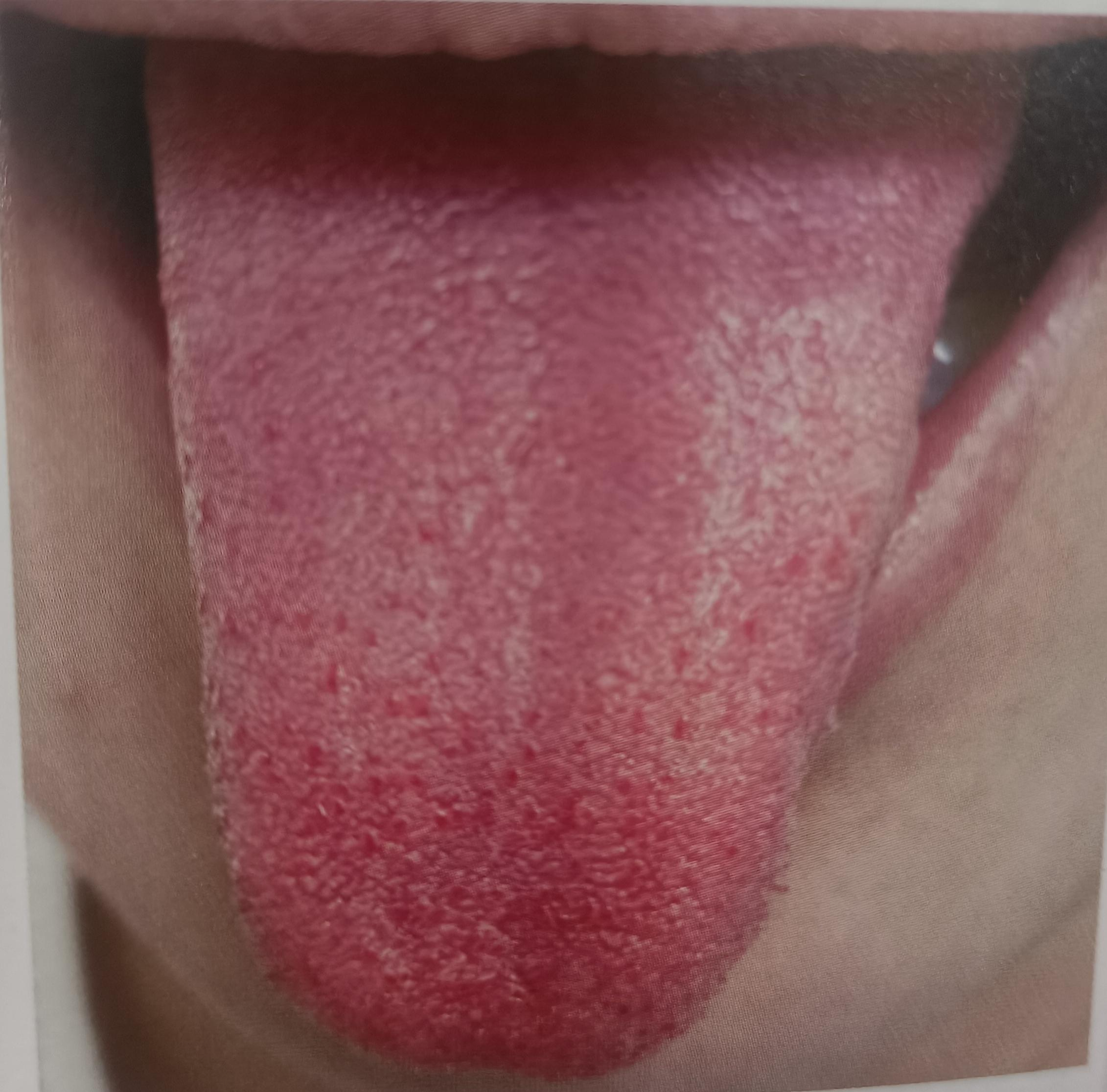 快餐达人路边泻火全攻略：从入门到精通